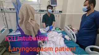 ICU Intubation how to insert ETT in Laryngospasm patient [upl. by Ellirehs]