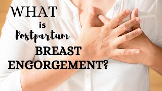 Postpartum Breast Engorgement information and tips for newborn breastfeeding [upl. by Ahsito266]