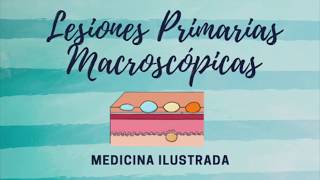 Dermatología   Lesiones Macroscópicas Primarias [upl. by Eehtomit]