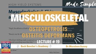 Osteopetrosis Osteitis deformans  Musculoskeletal  19  First Aid USMLE in UrduHindi [upl. by Aillemac]