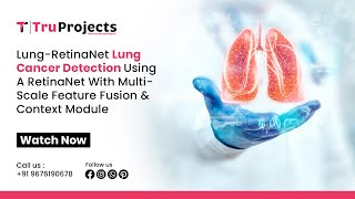 Lung RetinaNet Lung Cancer Detection Using a RetinaNet With Multi Scale Feature Fusion and Context M [upl. by Hamilah402]