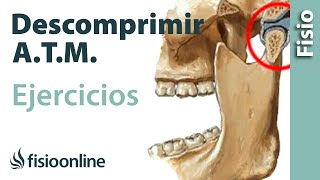 La ATM y el Síndrome de Dolor Miofascial Animación Alila Medical Media Español [upl. by Ahsiea509]