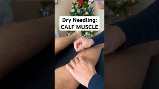 Calf TWITCHES during Dry Needling musclerelease [upl. by Namar]