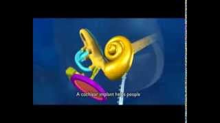 Cochlear implants  how do they work [upl. by Neellok]