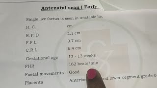 FHR in Male Baby in Odia।Pregnancy Ultrasound Report।Baby boy or girl symptoms during Pregnancy। [upl. by Lemuel634]