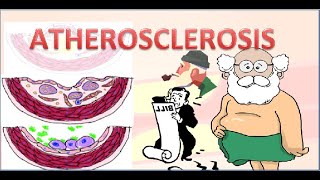 Atherosclerosis Pathophysiology [upl. by Shantee]