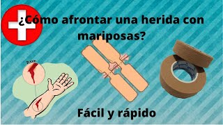 ¿cómo afrontar una herida con mariposas  Heridas  Enfermería [upl. by Cyndie]