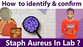 How to identify amp Confirm Staphylococcus Aureus in laboratory [upl. by Yeruoc]