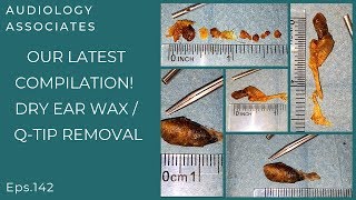 OUR LATEST EAR WAXQTIP REMOVAL COMPILATION  EP 142 [upl. by Odilia]