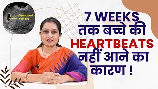 Why Heart Beat Never Comes In Early Pregnancy [upl. by Elyod]