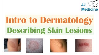 Introduction to Dermatology  The Basics  Describing Skin Lesions Primary amp Secondary Morphology [upl. by Cowey694]