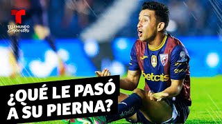 Christian “Hobbit” Bermúdez sufre una horrible lesión en México  Telemundo Deportes [upl. by Citarella]