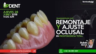 Remontaje y ajuste oclusal en prostodoncia total [upl. by Erialcyram600]