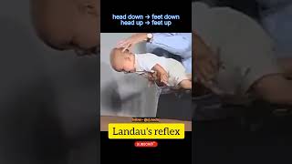 Landaus Reflex  normal baby reflexes  Pediatrics [upl. by Clevey]