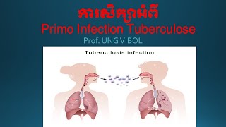 ការសិក្សាអំពី Primo Infection Tuberculose [upl. by Yeclehc]