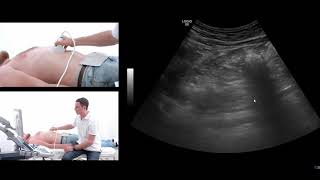 How to perform an ultrasound exam of the pancreas [upl. by Notsag247]