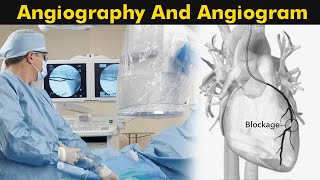 What is Angiography and Angiogram  How Angiography is performed 3D Animation [upl. by Dinnage]