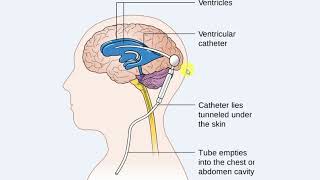 Pediatrics  Neuro  3  MENINGITIS  Basics [upl. by Lusty]