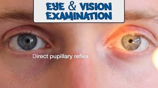 Examination of the Eyes and Vision  OSCE Guide old version  UKMLA  CPSA [upl. by Petrick512]