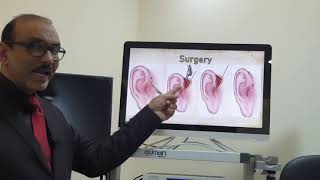 Preauricular sinus English Patient teaching programme [upl. by Ellora722]