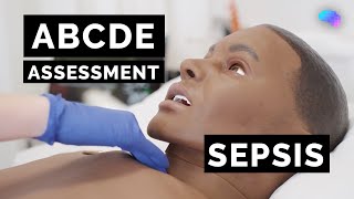 ABCDE Assessment  Sepsis  Emergency Simulation Scenario  OSCE Guide  UKMLA  CPSA [upl. by Raquel]