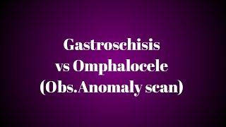 Gastroschisis vs Omphalocele [upl. by Inaliak]