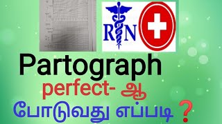 Partograph and its importanceHow to put perfect partograph in tamil [upl. by Briney]