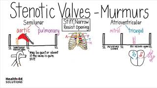 Heart Murmurs and Valve Disease Heart Murmur Series [upl. by Cohla]