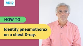 How to identify pneumothorax on a chest Xray [upl. by Aiciled]