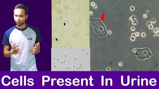 Epithelial cells in Urine  Normal Value  Causes TreatmentUrinalysis epithelial cell kya hota hn [upl. by Udell]