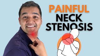 What Actually Causes Painful Neck Cervical Stenosis [upl. by Ynnaf233]