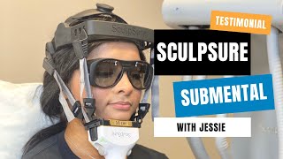 Sculpsure Submental Double Chin Results  San Antonio TX  Sculpt Away [upl. by Segroeg]