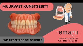 Kunstgebit gehemelte vrije kunstgebit implantaat klickgebit frictie stegprothese [upl. by Kristan]