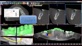 Software 3Diagnosys [upl. by Nyre130]