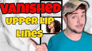 How To Get Rid Of Lip Lines and Upper Lip Wrinkles  Chris Gibson [upl. by Nitsir63]