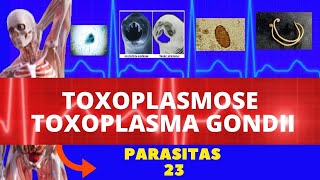 TOXOPLASMOSE TOXOPLASMA GONDII  PARASITOLOGIA  INFECTOLOGIA [upl. by Naol]