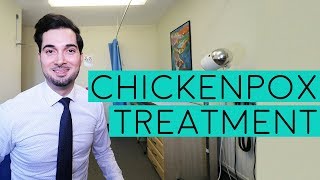 Chickenpox Treatment  Treatment For Chickenpox  Chickenpox Symptoms  Signs Of Chickenpox  2018 [upl. by Vickey]