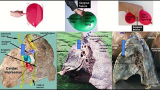 Azygos Vein amp Fissure on Radiology Xray CT amp MRI [upl. by Nallac]