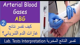 Lecture 2 2 Arterial Blood Gases analysis  ABG [upl. by Dilaw]