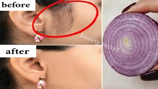 Stop shaving Heres how to get rid permanently facial body and pubic hair [upl. by Laup992]