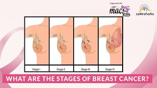 What are the stages of breast cancer [upl. by Acissj]