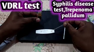 VDRL test  Syphilis disease test Treponema pallidum bacteria  Sexually transmitted disease [upl. by Heyde]