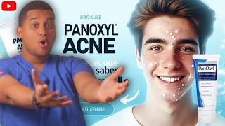 PanOxyl ACNE  3 Cosas Antes de Usarlo ¡ALERTA [upl. by Nnylyahs]