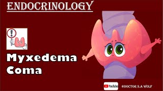 Myxedema Coma  Causes Pathophysiology Treatment [upl. by Anivram635]