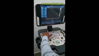 Mindray DC30 cardiac system Demo [upl. by Ailimaj]