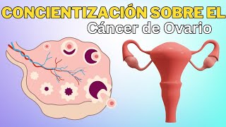 Concientización sobre el cáncer de ovario causas diagnóstico y tratamiento oncológico ginecológico [upl. by Nedia920]