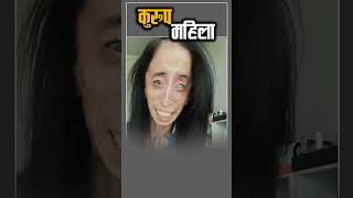 विश्वकै कुरुप केटी Lizzie Velásquez Worlds Ugliest Woman [upl. by Ecirtnuahs]