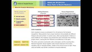 Understanding Nemaline Myopathy An Animation [upl. by Neelik]