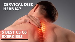 Best Exercises For C5 C6 Bulging Disc  C5 C6 Herniated Disc Exercises by Dr Walter Salubro [upl. by Ahsienaj]