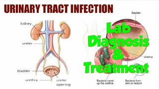 Laboratory diagnosis of UTI amp Treatment In hindi [upl. by Synned609]